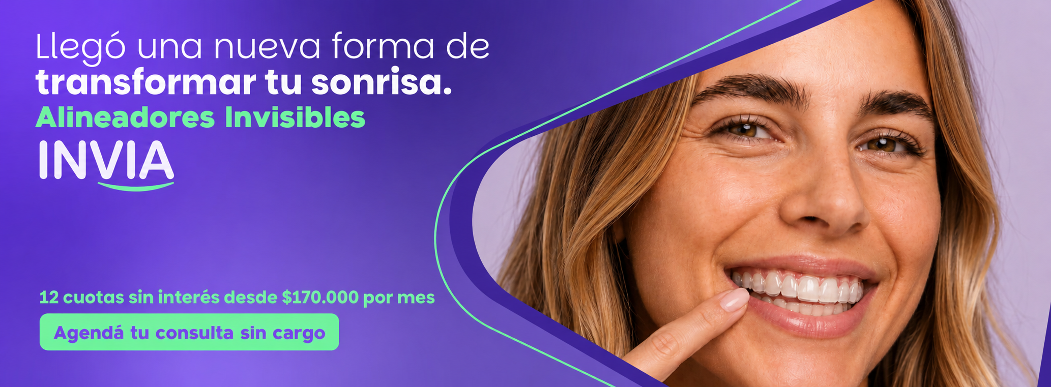 banner de alineadores invia 12 cuotas sin interes
